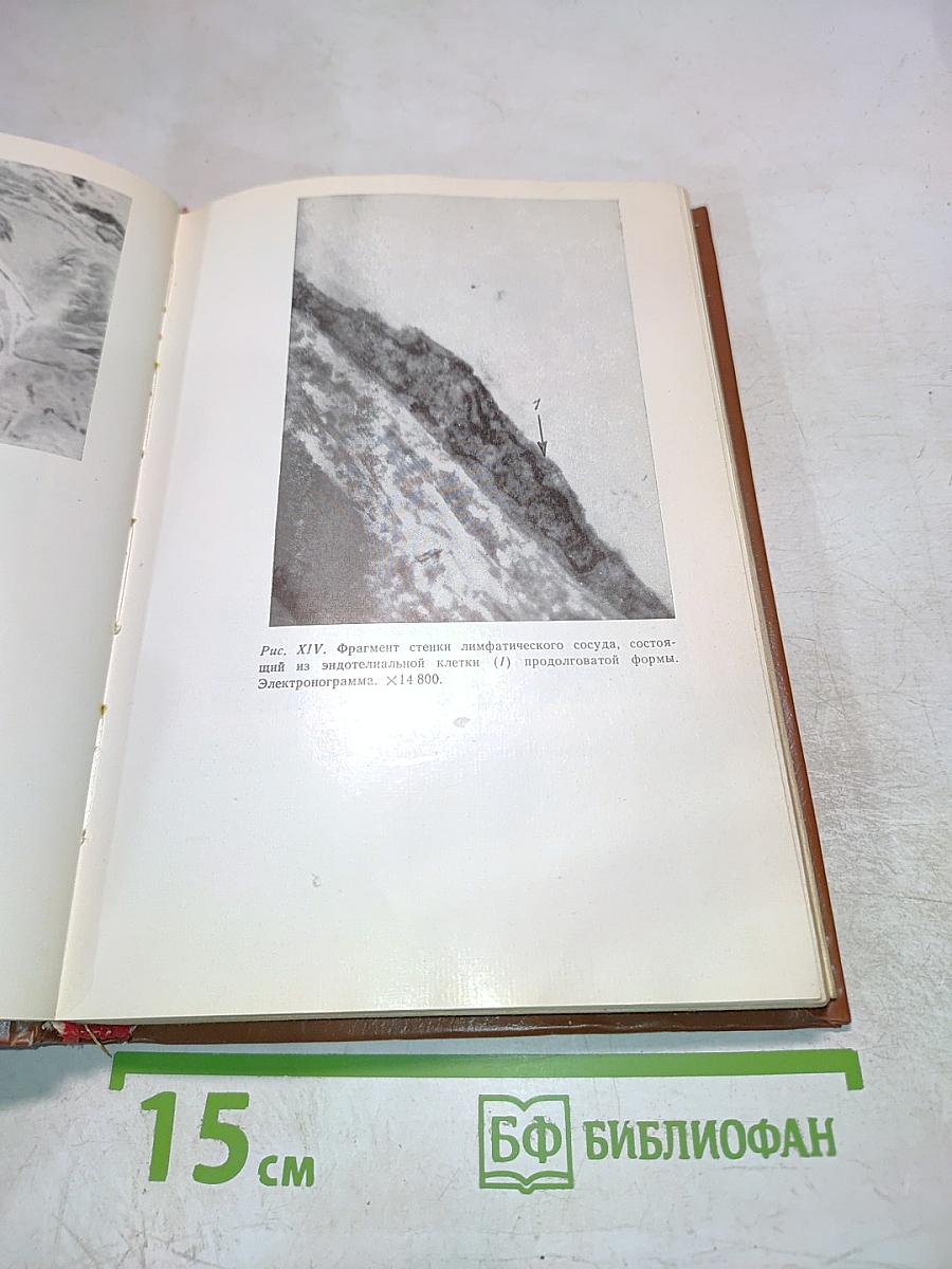 Электропунктурная рефлексотерапия