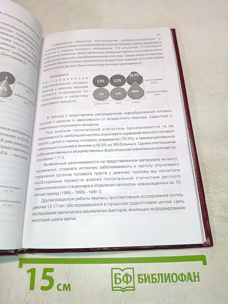 Опухоли и опухолевидные образования половых органов у девочек