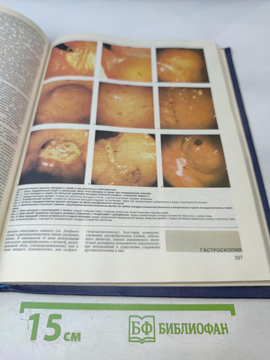 Малая медицинская энциклопедия. Том 1. А — Грудной ребенок