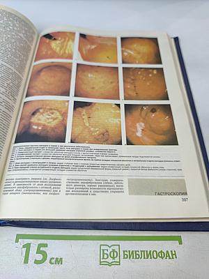 Малая медицинская энциклопедия. Том 1. А — Грудной ребенок