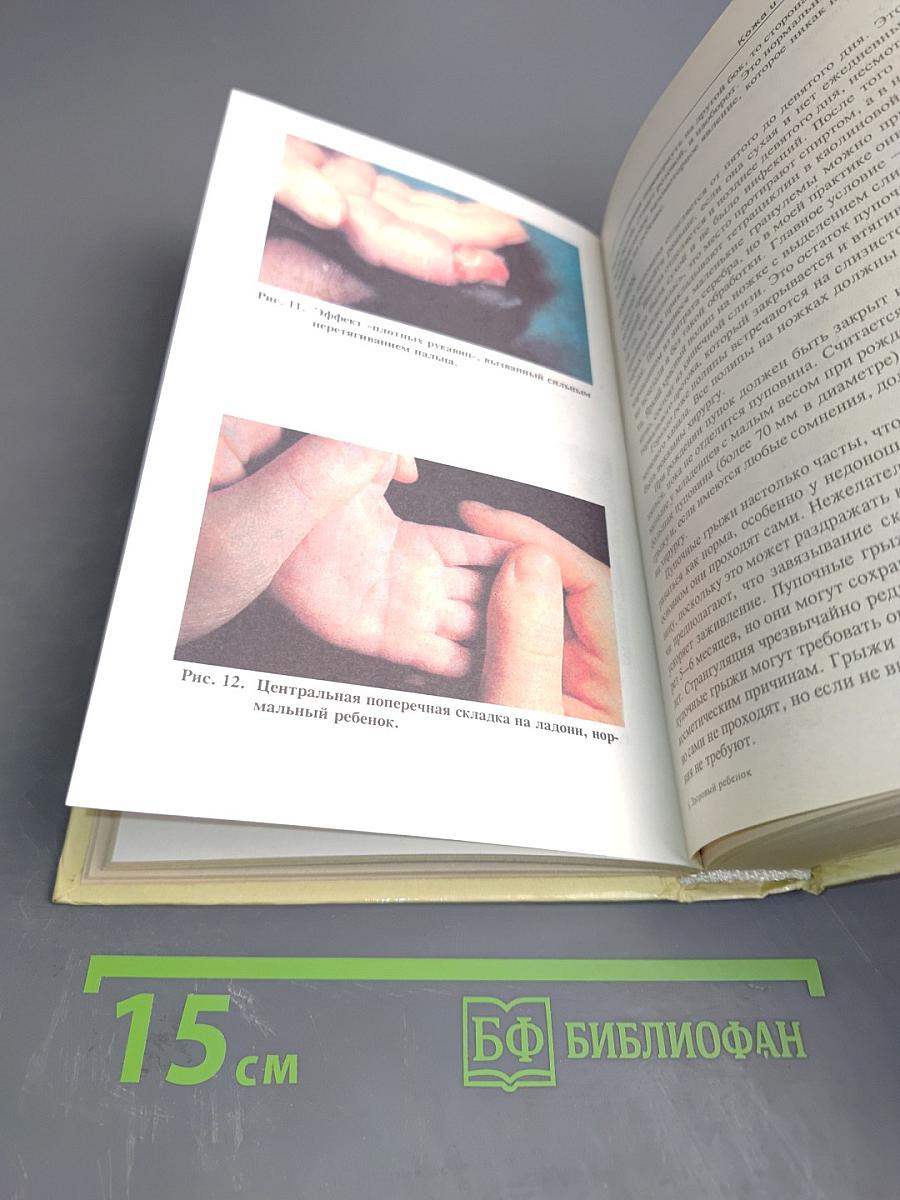 Здоровый ребенок: некоторые проблемы первых лет жизни и их лечение