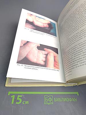 Здоровый ребенок: некоторые проблемы первых лет жизни и их лечение