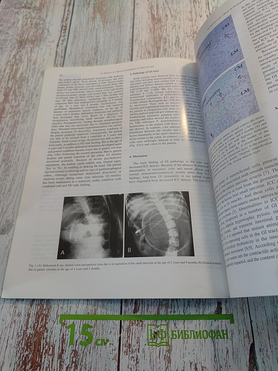 Brain & Development Volume 27 Number 6 September 2005