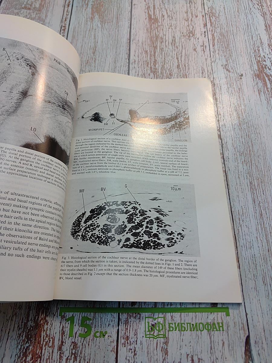 Brain Research. International Multidisciplinary Journal Devoted to Fundamental Research in the Brain Sciences. Vol. 115 No. 1