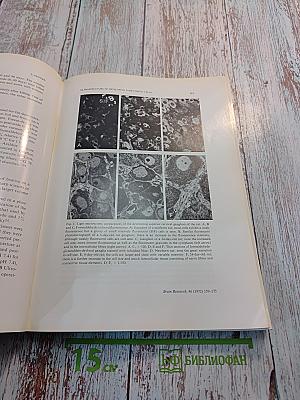 Brain Research, Volume 46