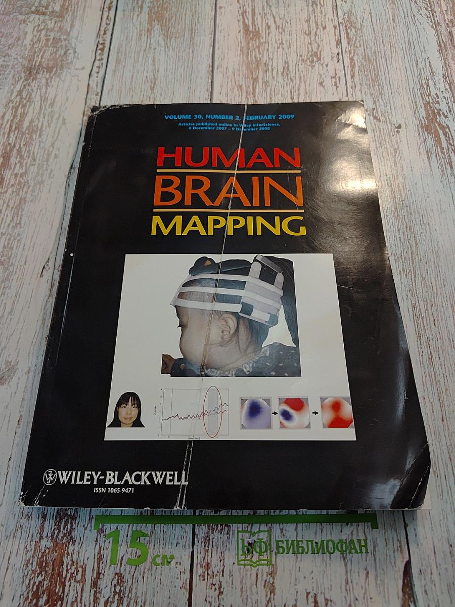 Human Brain Mapping Volume 30, Number 2, February 2009