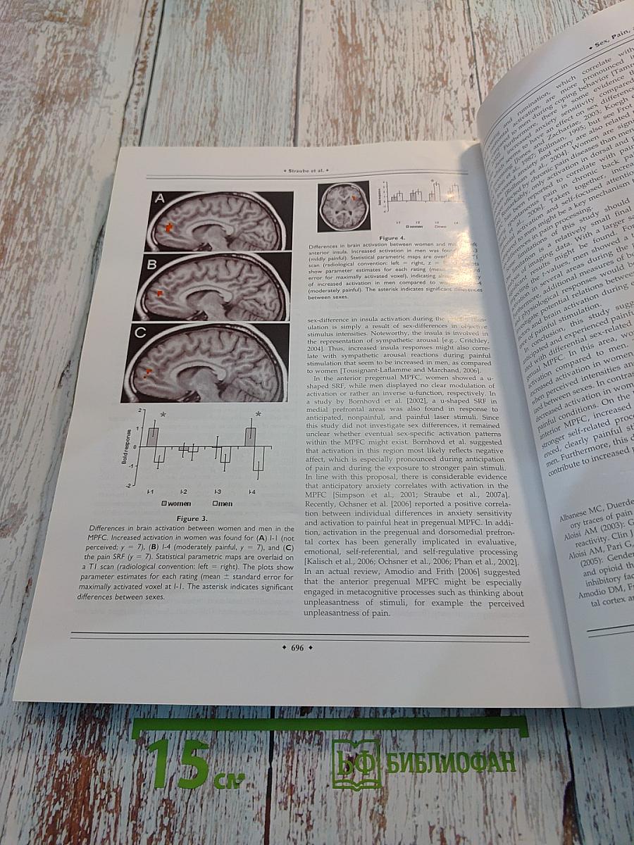 Human Brain Mapping Volume 30, Number 2, February 2009