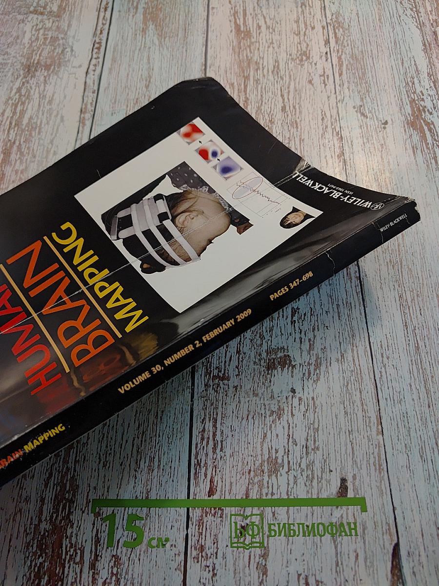 Human Brain Mapping Volume 30, Number 2, February 2009