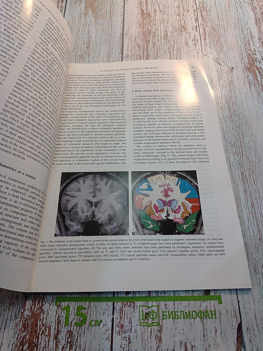 Brain & Development, Vol. 21 No. 5