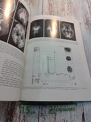 Brain & Development, Vol. 21 No. 5