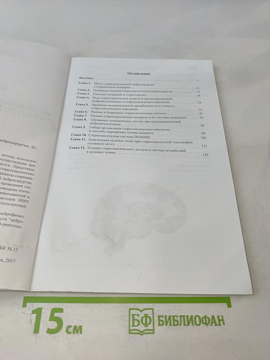 Методы наведения в современной стереотаксической нейрохирургии