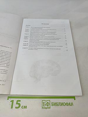 Методы наведения в современной стереотаксической нейрохирургии