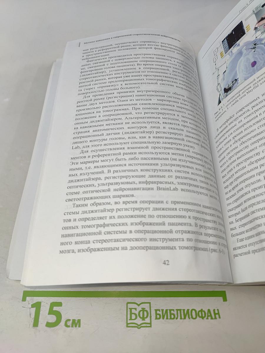 Методы наведения в современной стереотаксической нейрохирургии