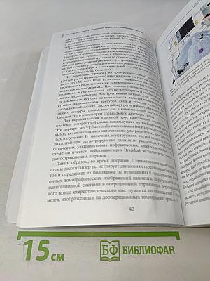 Методы наведения в современной стереотаксической нейрохирургии