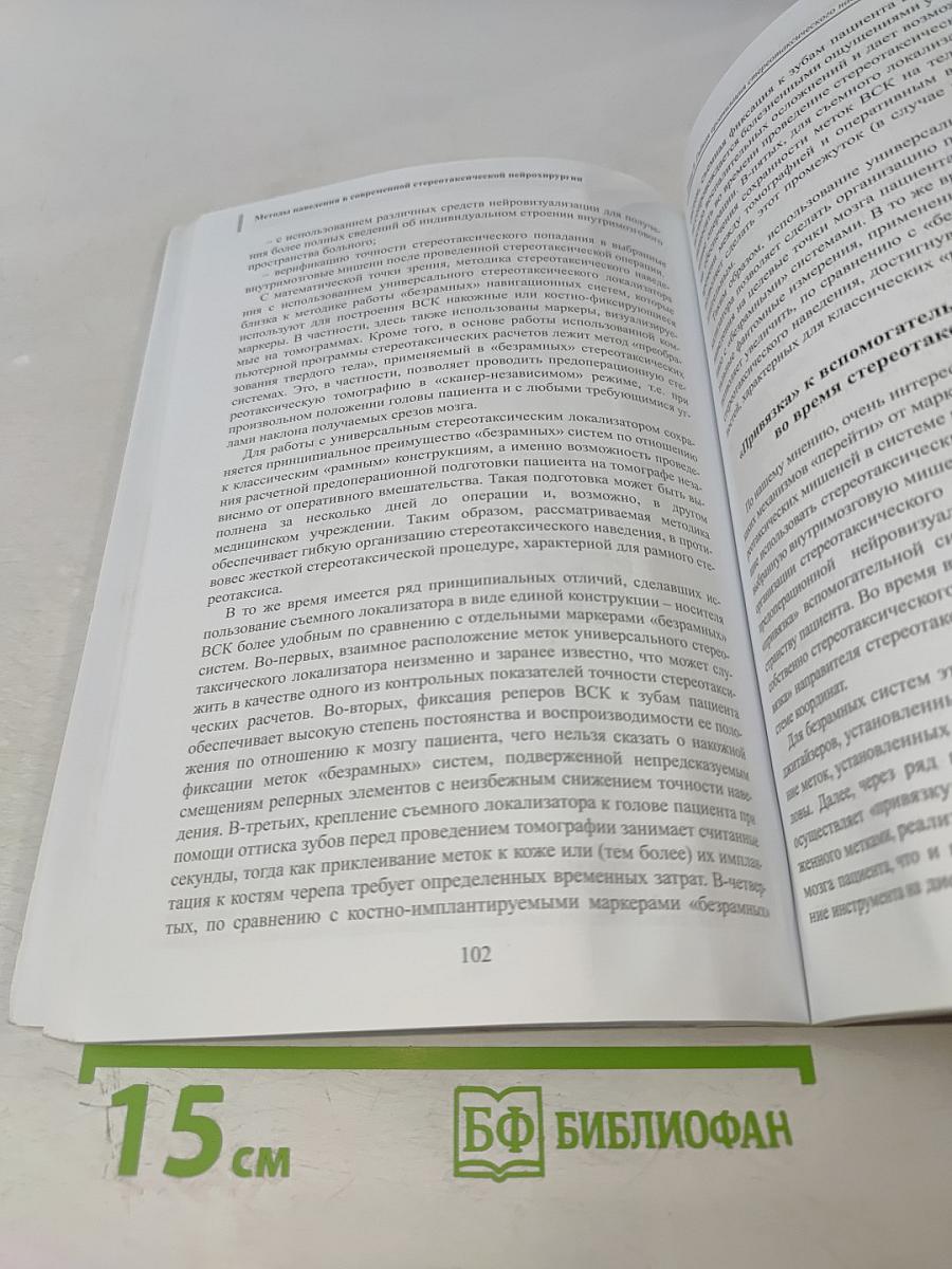 Методы наведения в современной стереотаксической нейрохирургии