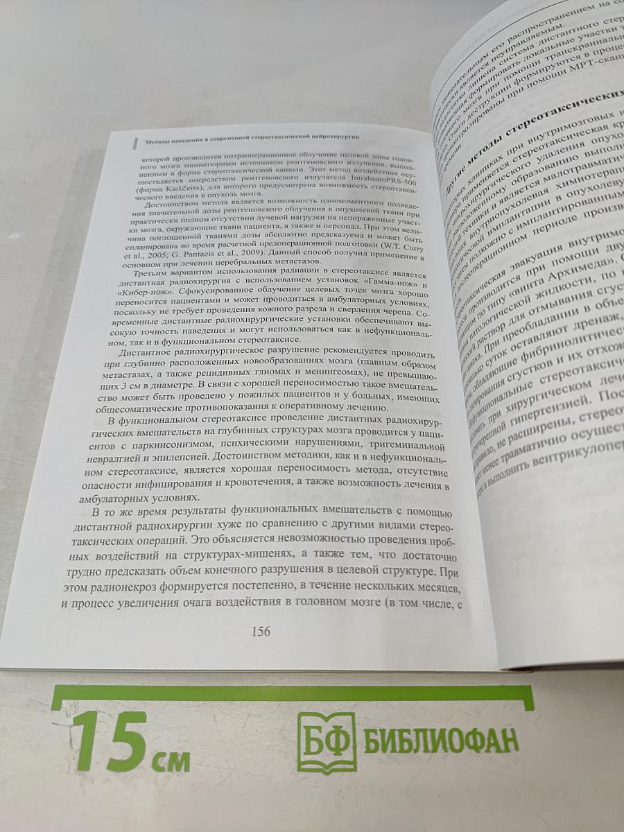 Методы наведения в современной стереотаксической нейрохирургии