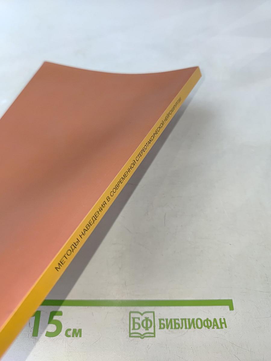 Методы наведения в современной стереотаксической нейрохирургии