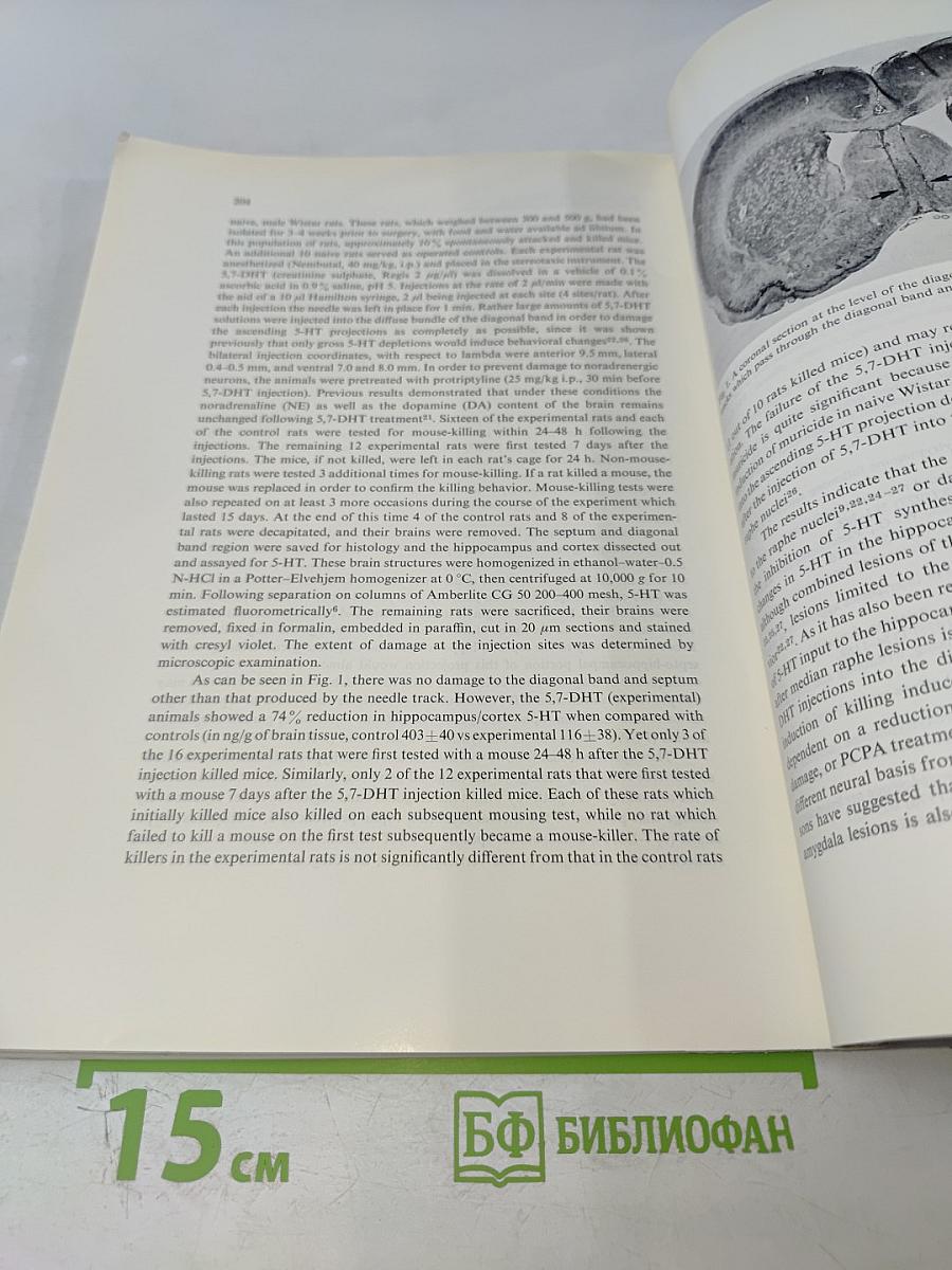 Brain Research. Vol. 185 No. 1