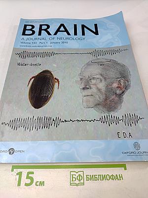 Brain: A Journal of Neurology, Volume 133, Part 1 (Январь 2010)