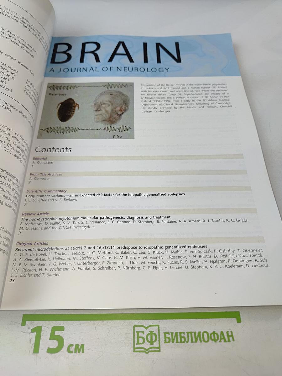 Brain: A Journal of Neurology, Volume 133, Part 1 (Январь 2010)