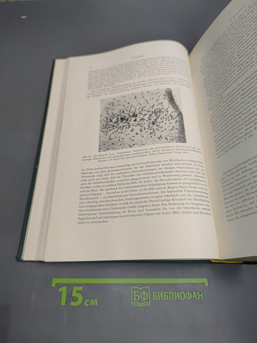 Paidopathologie. kyematopathien neogonopathien thelamonopathien. lehrbuch und atlas