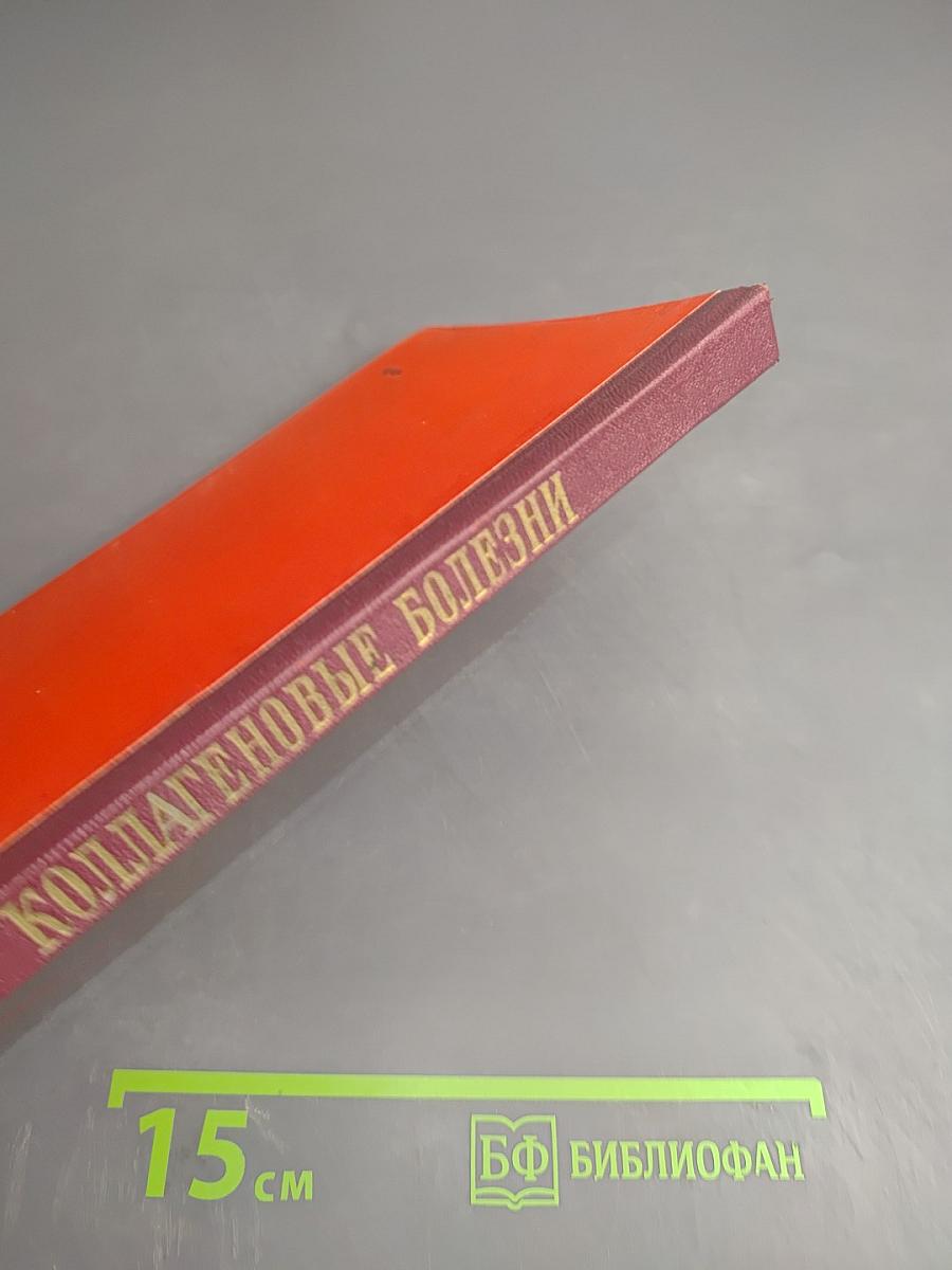 Коллагеновые болезни