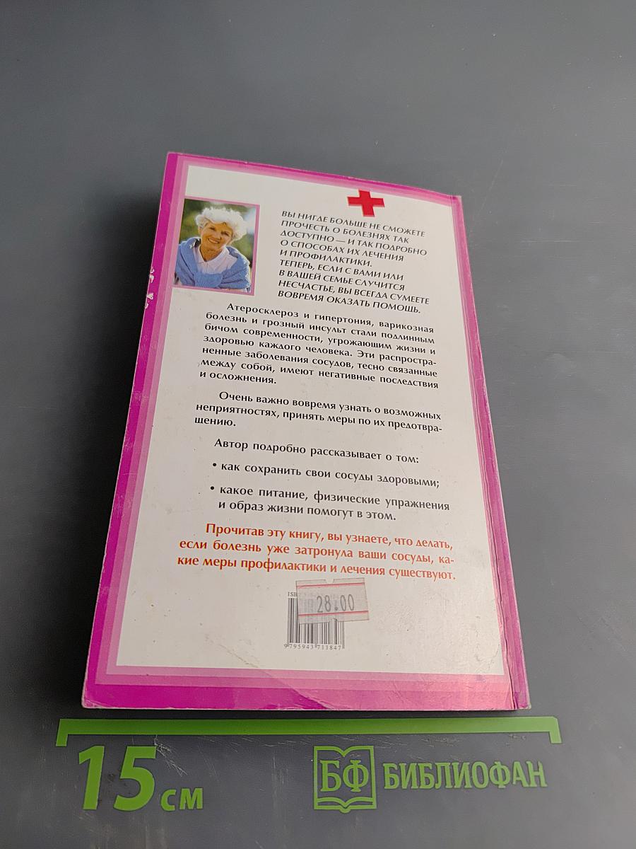 Болезни сосудов: причины, лечение, профилактика