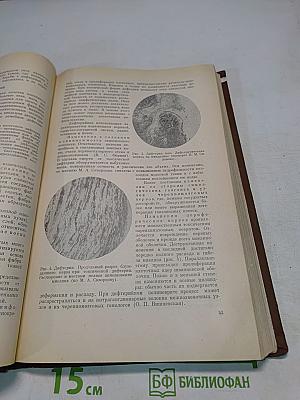 Учебник детских инфекционных болезней