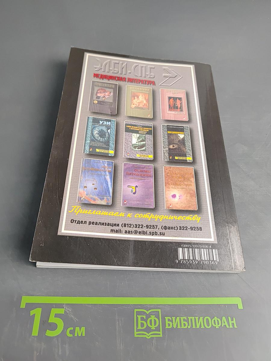 Рассеянный склероз