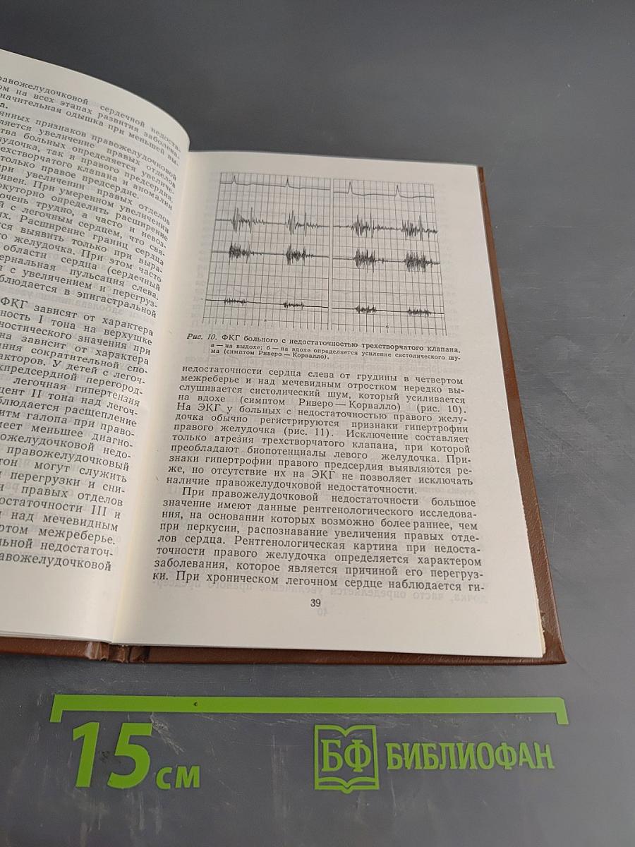 Сердечная недостаточность у детей