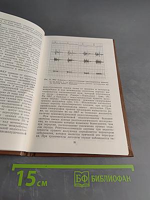 Сердечная недостаточность у детей