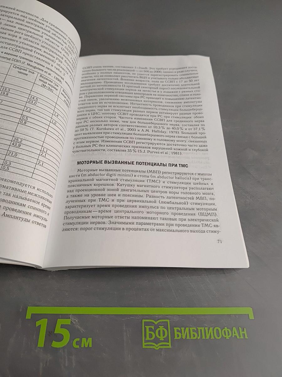 Рассеянный склероз: диагностика, лечение, специалисты