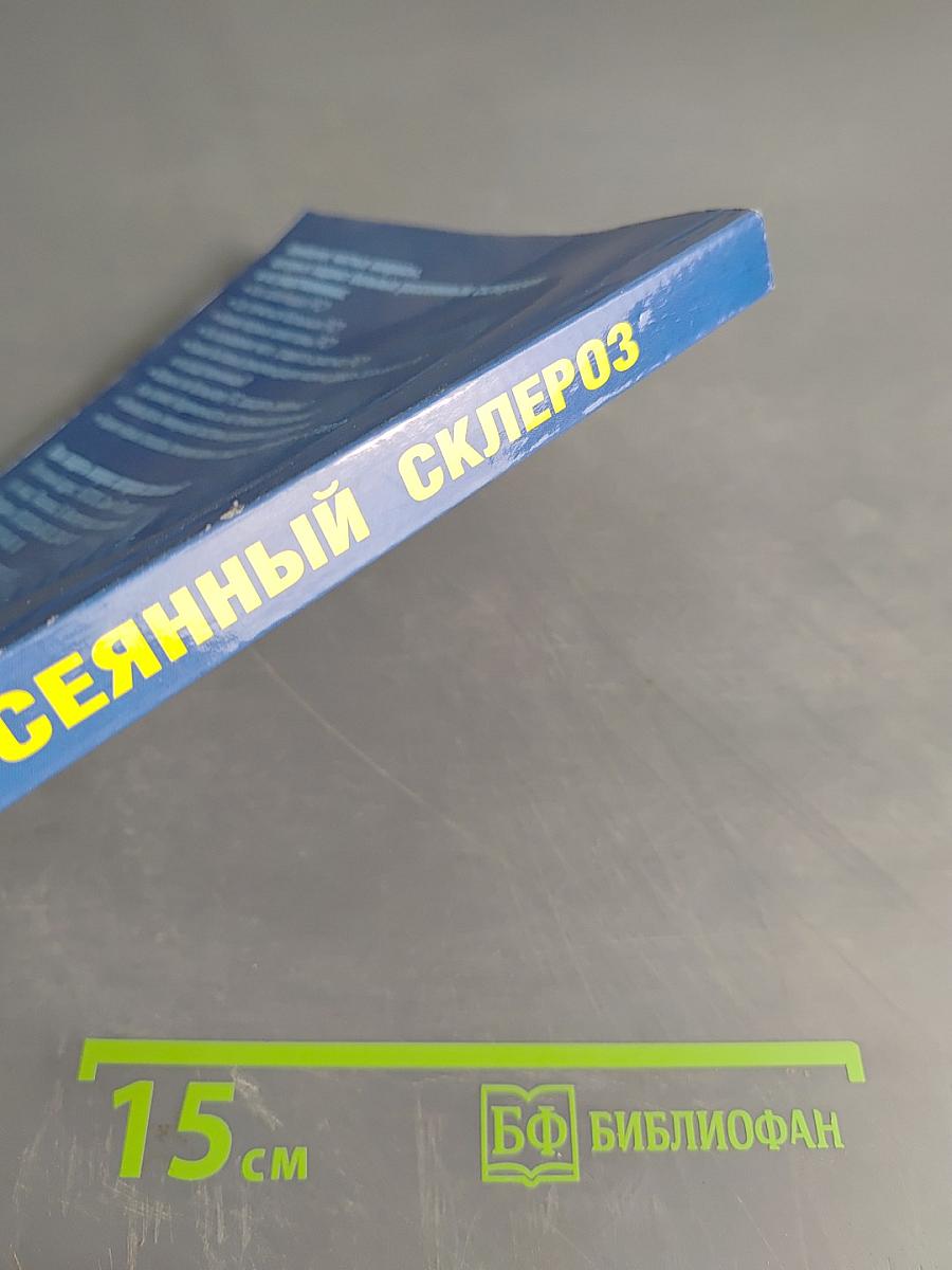 Рассеянный склероз: диагностика, лечение, специалисты