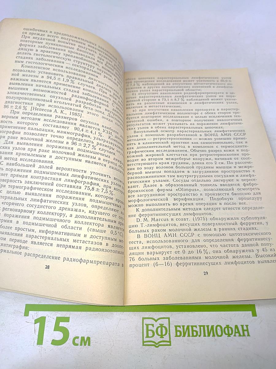 Лечение опухолей молочной железы