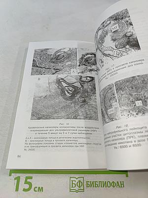 Профилактика и лечение оппортунистических инфекций, кандидозов и гельминтозов. Книга 1