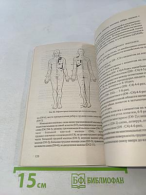 Сегментарный массаж