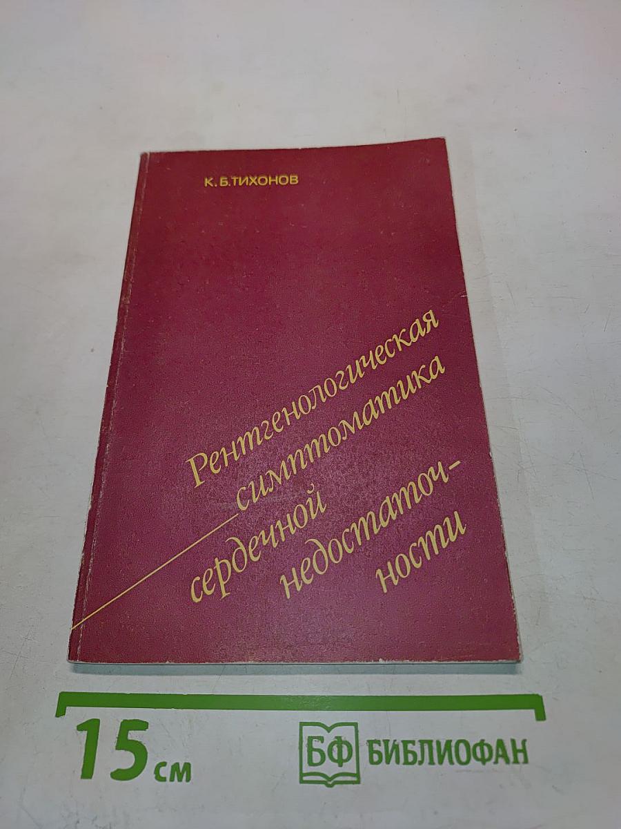Рентгенологическая симптоматика сердечной недостаточности