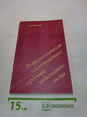 Рентгенологическая симптоматика сердечной недостаточности