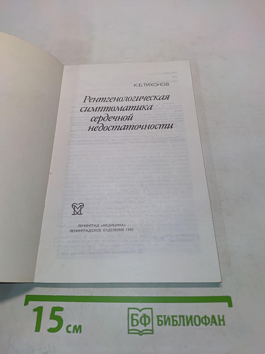 Рентгенологическая симптоматика сердечной недостаточности