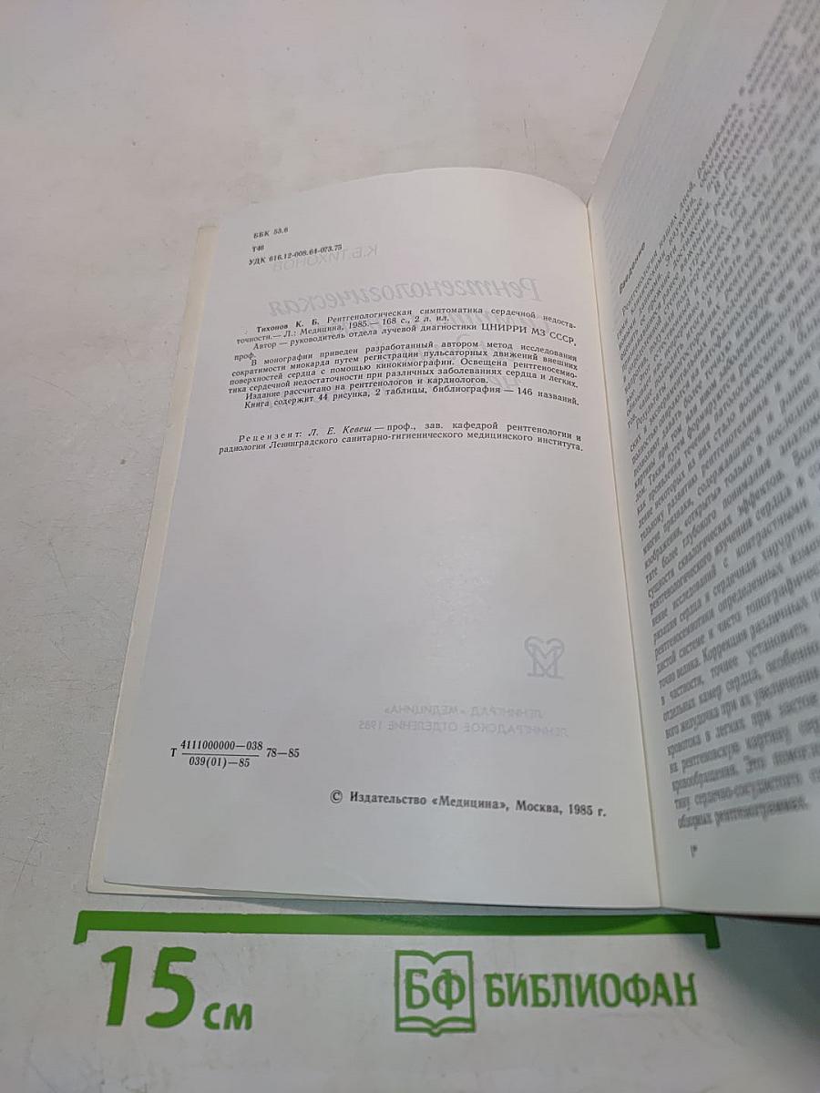 Рентгенологическая симптоматика сердечной недостаточности