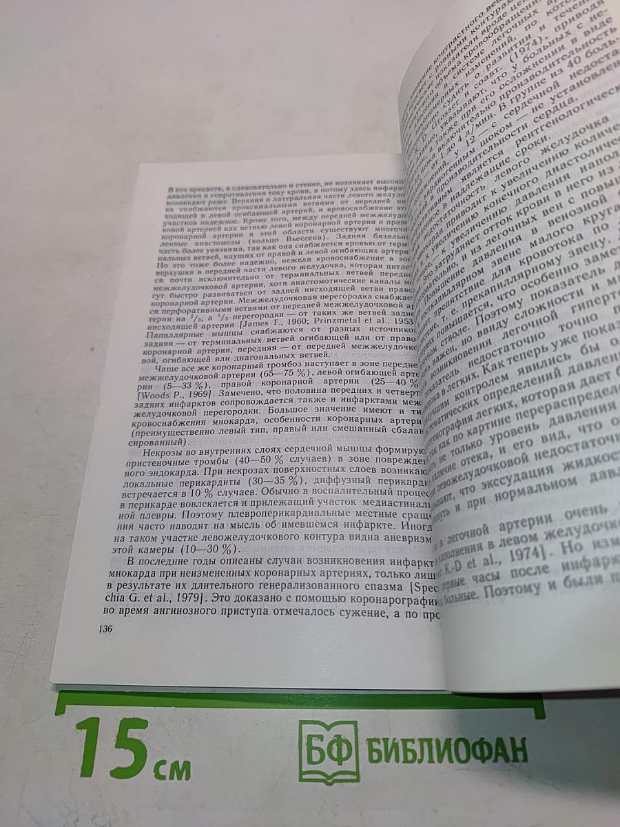 Рентгенологическая симптоматика сердечной недостаточности