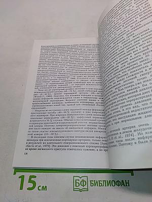 Рентгенологическая симптоматика сердечной недостаточности