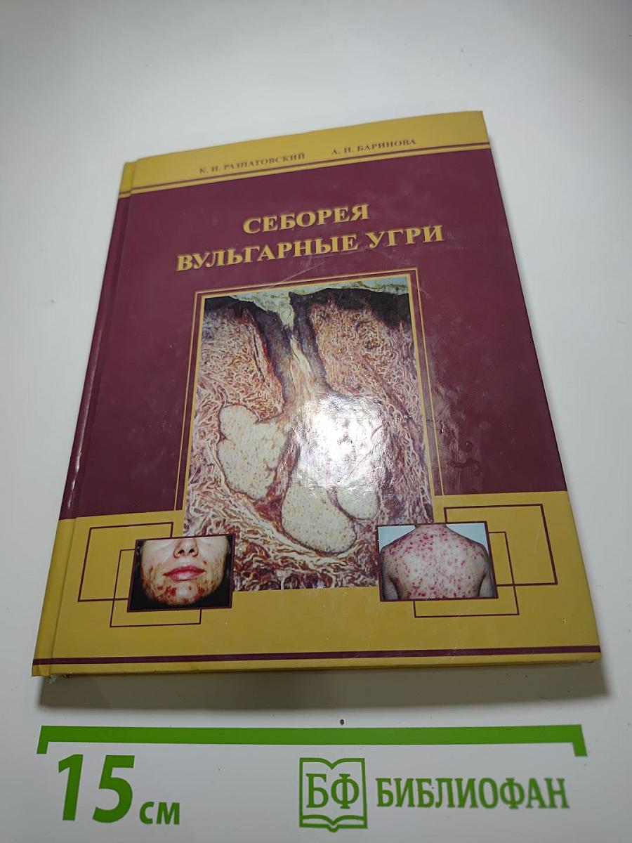 Себорея и вульгарные угри: эпидемиология, патогенез, клиника, лечение