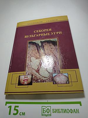 Себорея и вульгарные угри: эпидемиология, патогенез, клиника, лечение