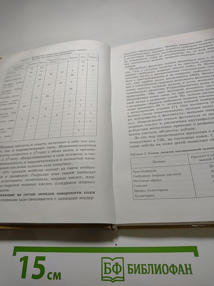 Себорея и вульгарные угри: эпидемиология, патогенез, клиника, лечение