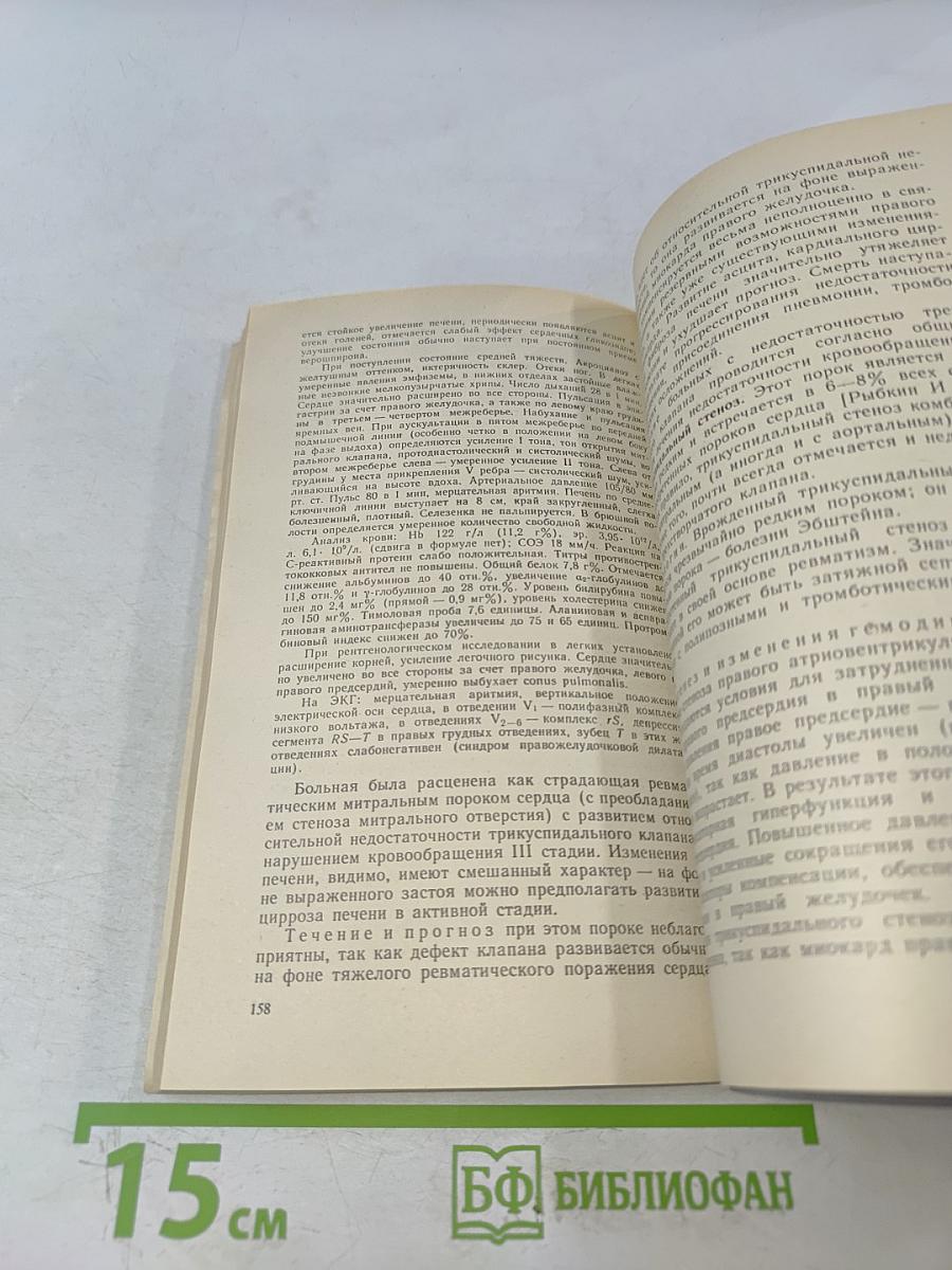 Приобретенные пороки сердца