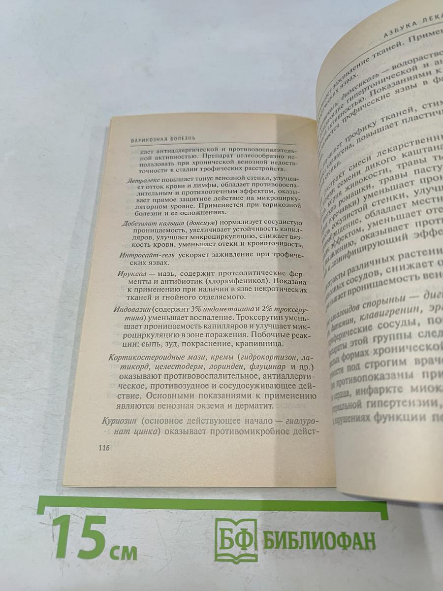 Варикозная болезнь