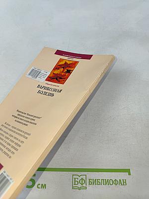 Варикозная болезнь
