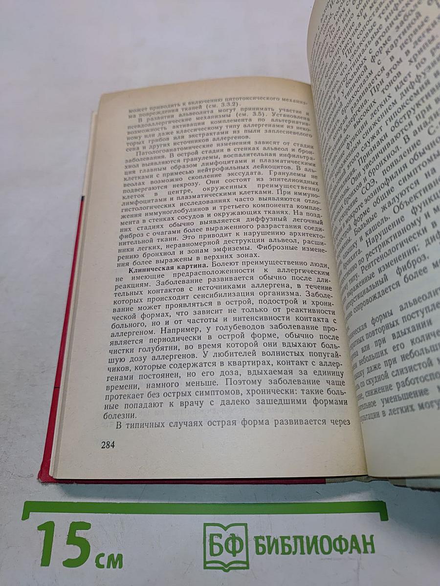 Аллергические заболевания