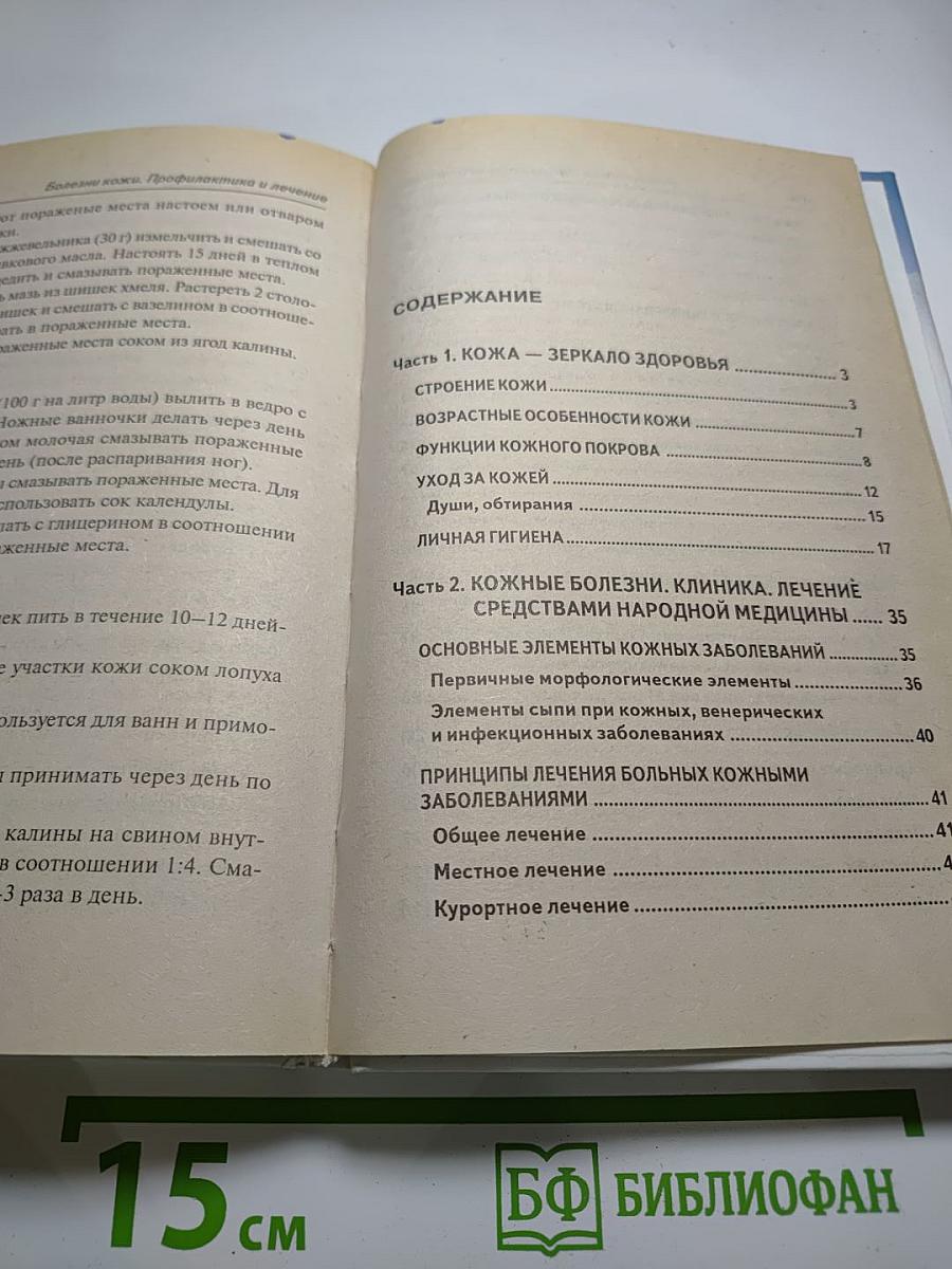 Болезни кожи. Профилактика и лечение